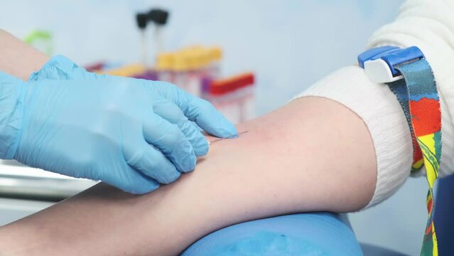 A female doctor takes a blood sample from a patient for testing in the hospital. Sampling of plasma for the treatment of patients with covid. Clinical researches.