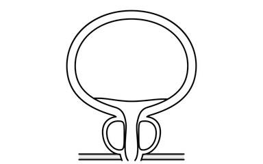 Medical illustration of benign prostatic hyperplasia, normal prostate