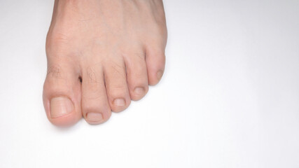 Close of a person left foot toes with white background and space for text