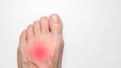 Instep of a person left foot with a red mark representing pain, with space on the right for text