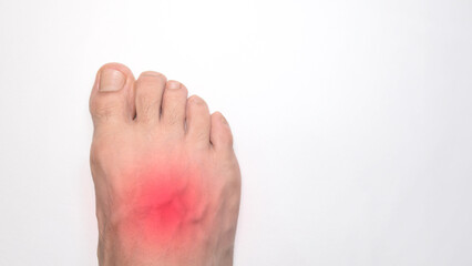 Close up of the instep of a person right foot with a red mark representing pain