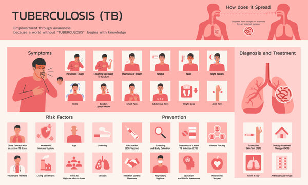 Tuberculosis Informative Infographic on Symptoms, Diagnosis, and Treatment, Vector Flat Illustration Design