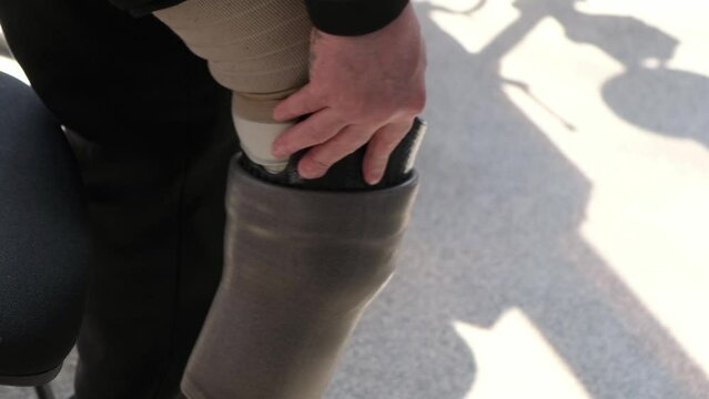 Preparing and fitting a bionic leg for a patient at a rehabilitation center. Healthcare, modern developments.