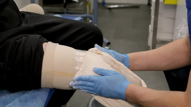 Prosthetic leg, Workplace tools and cast development. In a professional workshop, a man makes a plaster model of a prosthetic leg for a patient.