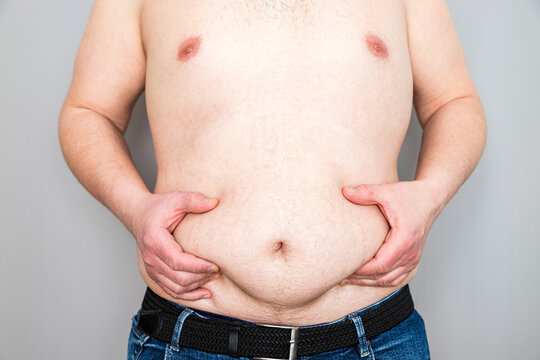Overweight Man Gripping Stomach Fat, Health Issue