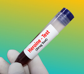Urine sample for Heroine drug test, It's technical analysis of specimen to determine illegal drug...