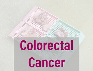 Colorectal cancer word, medical term word with medical concepts in blackboard and medical equipment