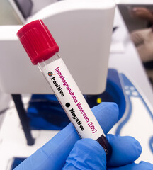 Blood sample for Lymphogranuloma Venereum (LGV) disease diagnosis test. LGV is a sexually...