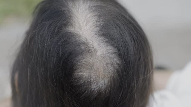 Senior aged asian woman concern about gray hair in menopause..