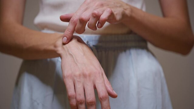 A middle-aged woman shows her veiny arms. Diseases of thrombosis and varicose veins.