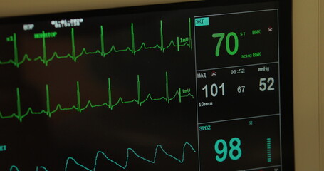 Electronic Health Monitor Machine Checks Vital Signs Of Ill Patient. Electronic Machine Detects...