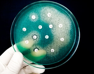 Antimicrobial susceptibility testing of Pseudomonas aeruginosa, mueller hinton agar plate.