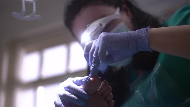 The podologist scrapes the nail with a buffing attachment 