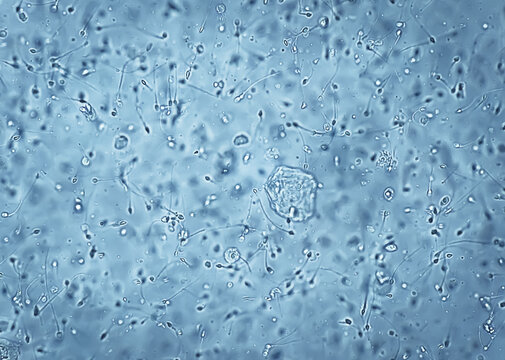 Мөлдір трусиктердегі мастурбация