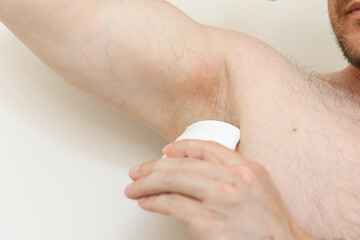 Young man with irritation, inflammation on sensitive underarm skin, using deodorant or antiperspirant for treatment armpit rash. Allergy, atopic dermatitis. Acne or red spots. Healthcare concept