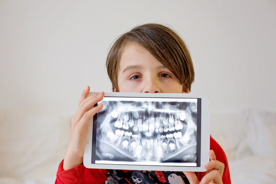Child, preteen boy, holding tablet with a picture of his x-ray teeth