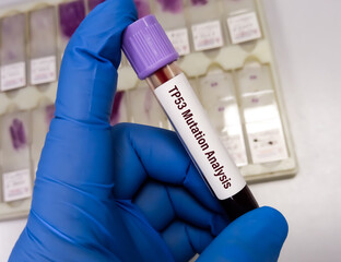 Blood sample for TP53 (tumor protein 53) mutation analysis testing, to determine risk of certain...