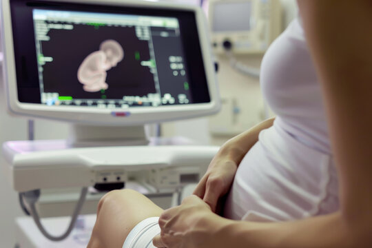 A pregnant woman having a 3D ultrasound at a doctor office.
