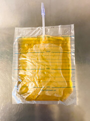 Closeup of a filled plastic urine bag in hospital with steel background.