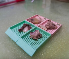 Histology tissue processing embedding cassettes during the specimen process in the biopsy laboratory.