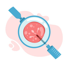 intra cytoplasmic Insemination of Sperm. artificial insemination