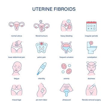 Uterine Fibroids symptoms, diagnostic and treatment vector icons. Medical icons.