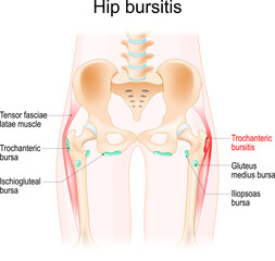 Hip bursitis. Muscles, Synovial bursas and bones of a human hip.