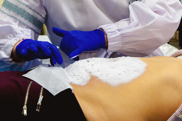 The person performs the procedure, possibly using a scrub or scrub solution. White powder is scattered on a woman's belly for an anti-cellulite procedure.