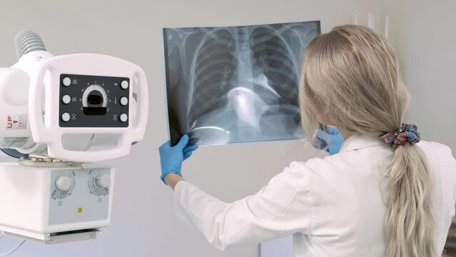 A doctor examines an X-ray of the lungs in a medical office. Concept of Covid, treatment and medical research.