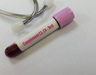 Blood Sample for C3, C4 (Complement) test with laboratory background. Closeup. Diagnosis of autoimmune disorders.