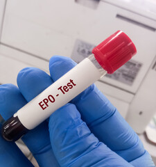 Blood sample for Erythropoietin (EPO) test, stimulating hormone for RBC production.