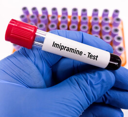 Blood sample for Imipramine test, is a tricyclic antidepressant mainly used to the treatment of...
