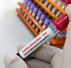 Blood sample for Cardiac biomarkers test to diagnosis of myocarditis. Enterovirus PCR test....