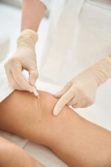 Obraz na płótnie Canvas Cosmetologist marking female client knees, going to do threadlifting procedure