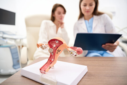 Uterus model with blurred doctor showing to woman patient her examining results