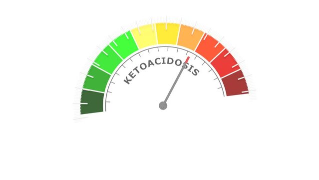 Ketoacidosis level on measure scale. Instrument scale with arrow. Colorful infographic gauge element. Ketoacidosis is a metabolic state