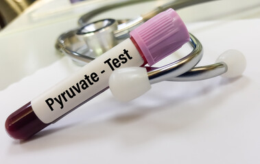 Blood sample for Pyruvate test.