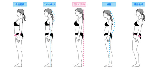 正しい姿勢と悪い姿勢 猫背 ストレートネック 骨盤前傾 後悔のイラストセット 全身横向き