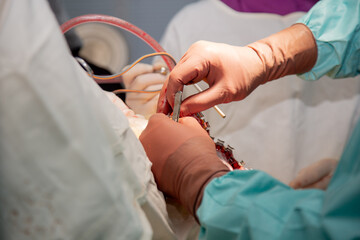 Surgeons perform an operation. Real photos from the operation.