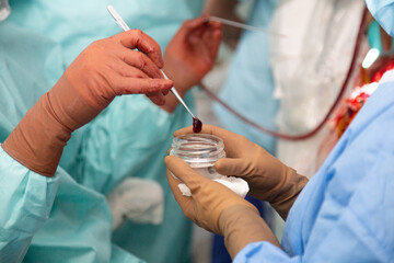 The doctor shows the cancerous tumor that he removed during the operation. Surgery to remove...