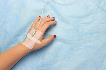 Peripheral catheter access in a woman’s hand. Close up of a arterial catheter
