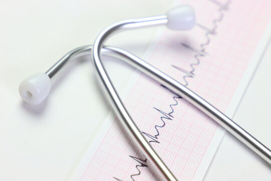 EKG paper with trace and a stethoscope in front of it. Close up view of the ekg trace