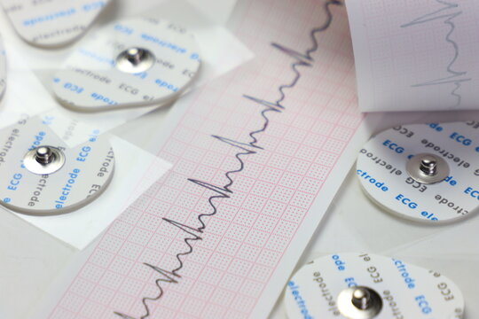 Ekg trace paper in a white background with ekg electrodes 