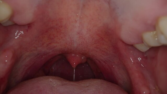 Macro View Inside The Mouth, The Camera Rotates and Goes Deeper into The Throat.