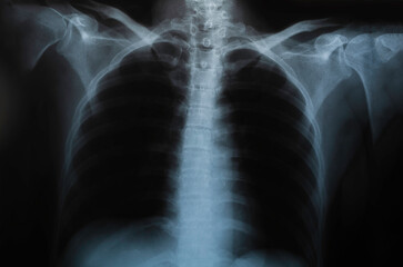 Doctor examining x-ray film of patient at hospital.