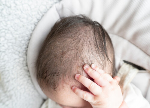 Baby scratches his head and blood oozes from the wound