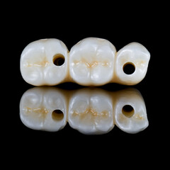 emax ceramic cowens on implants 