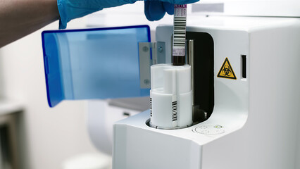 The scientist places blood samples into a modern automated blood chemistry device and monitors the...
