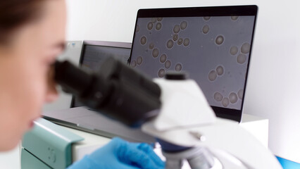Scientist in a modern medical laboratory looking into a microscope. Microbiologist works on...