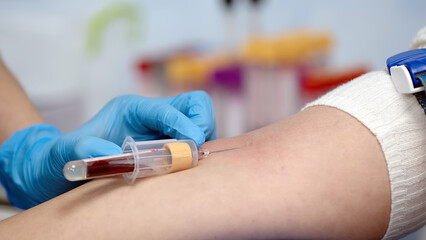 Blood donation close-up. Clinical studies, drugs, tests. Covid-19 pandemic and medicine concept.